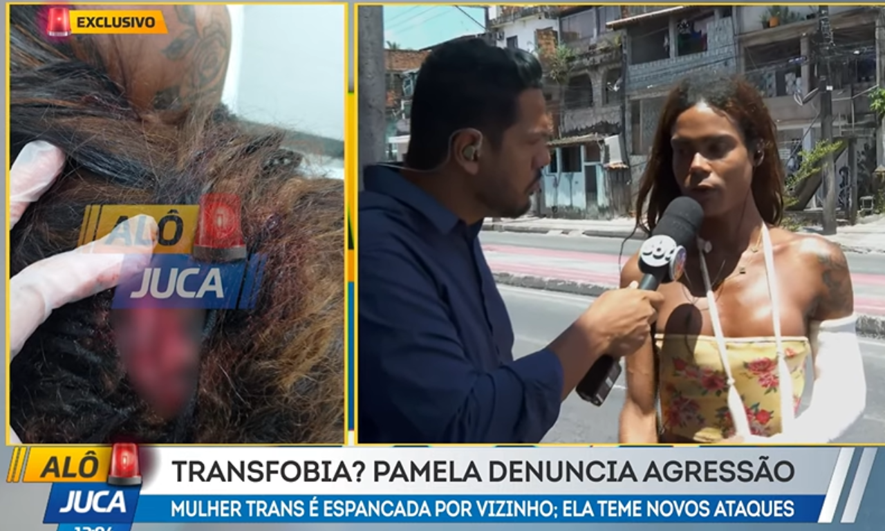 Mulher trans denuncia agressão de vizinho em Salvador: 'Não tem motivo'.Foto: TV Aratu