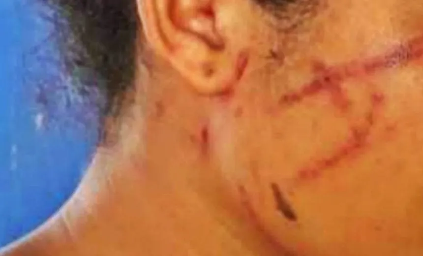Menina de 13 anos é agredida e ameaçada de morte pelo ex-namorado na Bahia