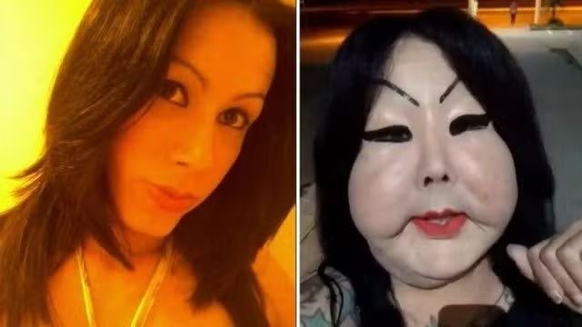 O m&eacute;dico explicou que o procedimento teve como objetivo corrigir detalhes que j&aacute; apresentavam necessidade de ajuste. | Foto: Redes Sociais/Jornal Extra