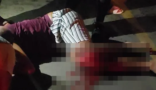 Acidente grave envolvendo um carro e uma motocicleta deixa duas pessoas feridas em Itaparica