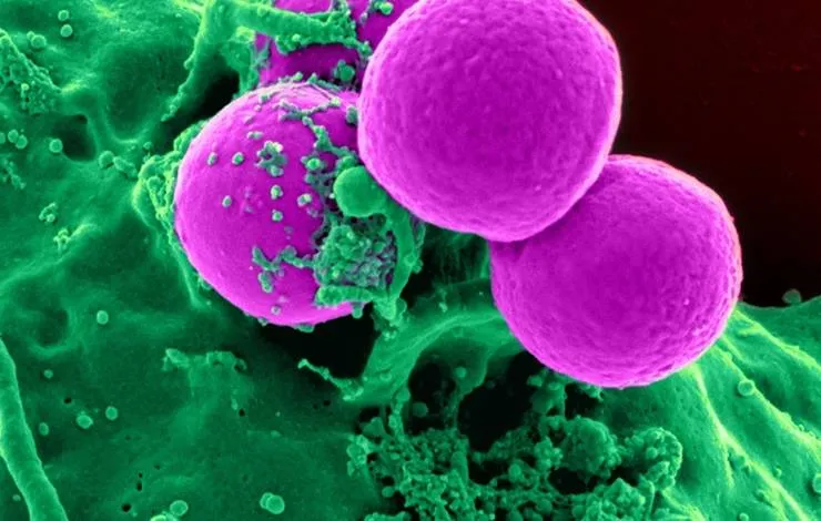 Ameba zumbi: homem tem cérebro "comido" por microorganismo