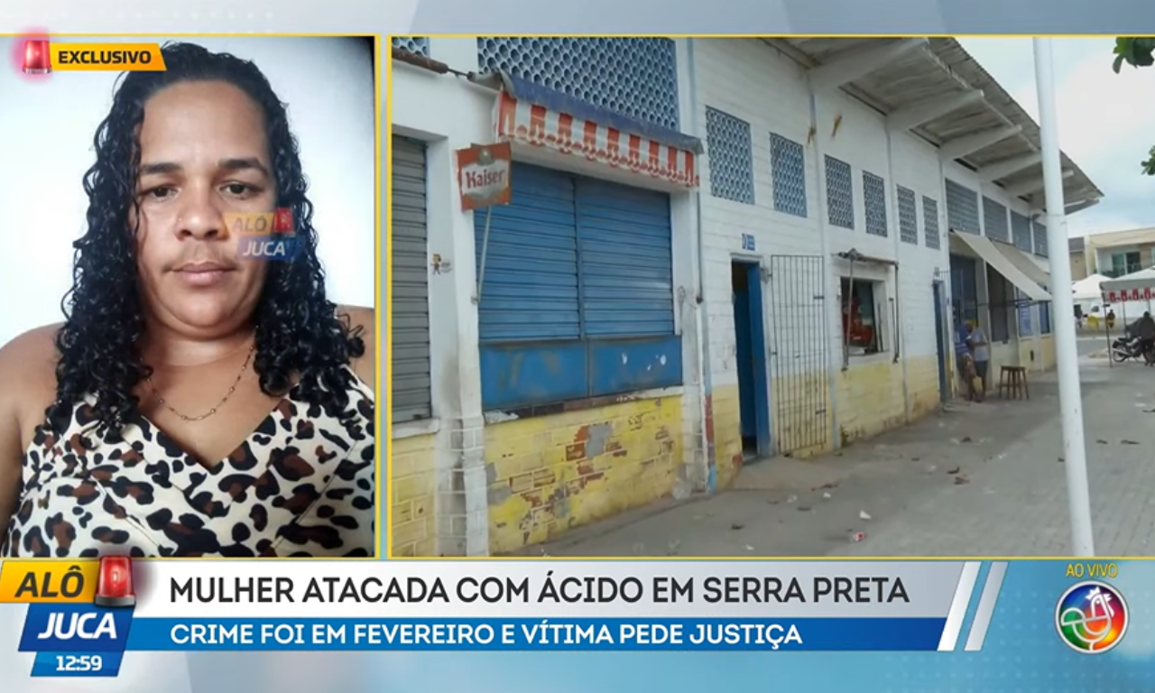 Vítima de ataque com ácido na Bahia cobra justiça: ‘Minha vida parou’.Foto: TV Aratu