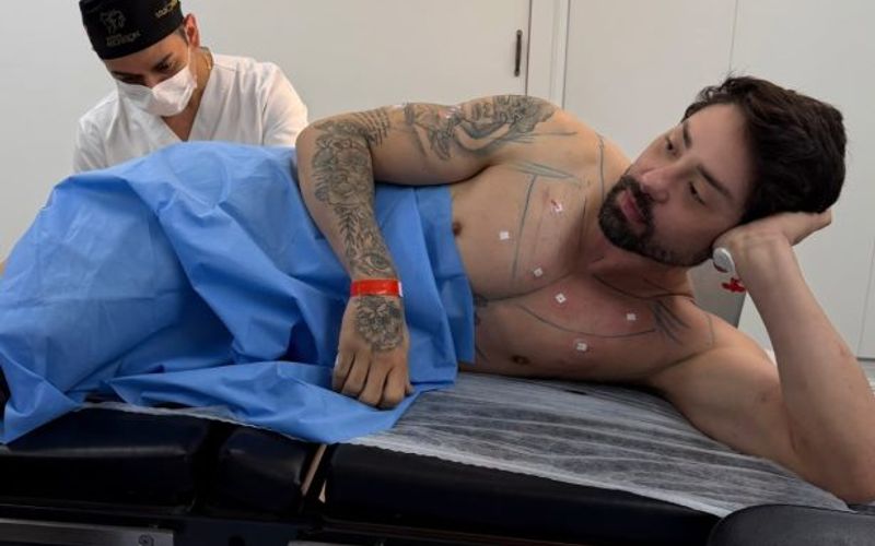 O procedimento divulgado por Rico Melquiades envolve a aplica&ccedil;&atilde;o de toxina botul&iacute;nica, subst&acirc;ncia que atua temporariamente na atividade muscular da regi&atilde;o tratada/Foto: Redes Sociais&nbsp;
