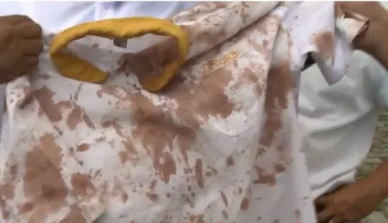 Rodoviário fica ensanguentado após ser agredido por casal que queria entrar pela traseira do ônibus em Salvador 