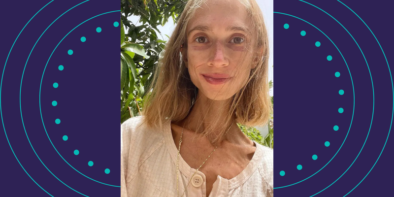 O caso de Karolina serve como alerta sobre os riscos da obsessão estética e da influência digital na construção da autoimagem/Foto: Redes Sociais 