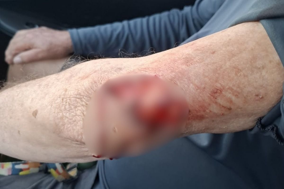 Idoso é atacado por pitbull na orla de Stella Maris. Foto: Reprodução
