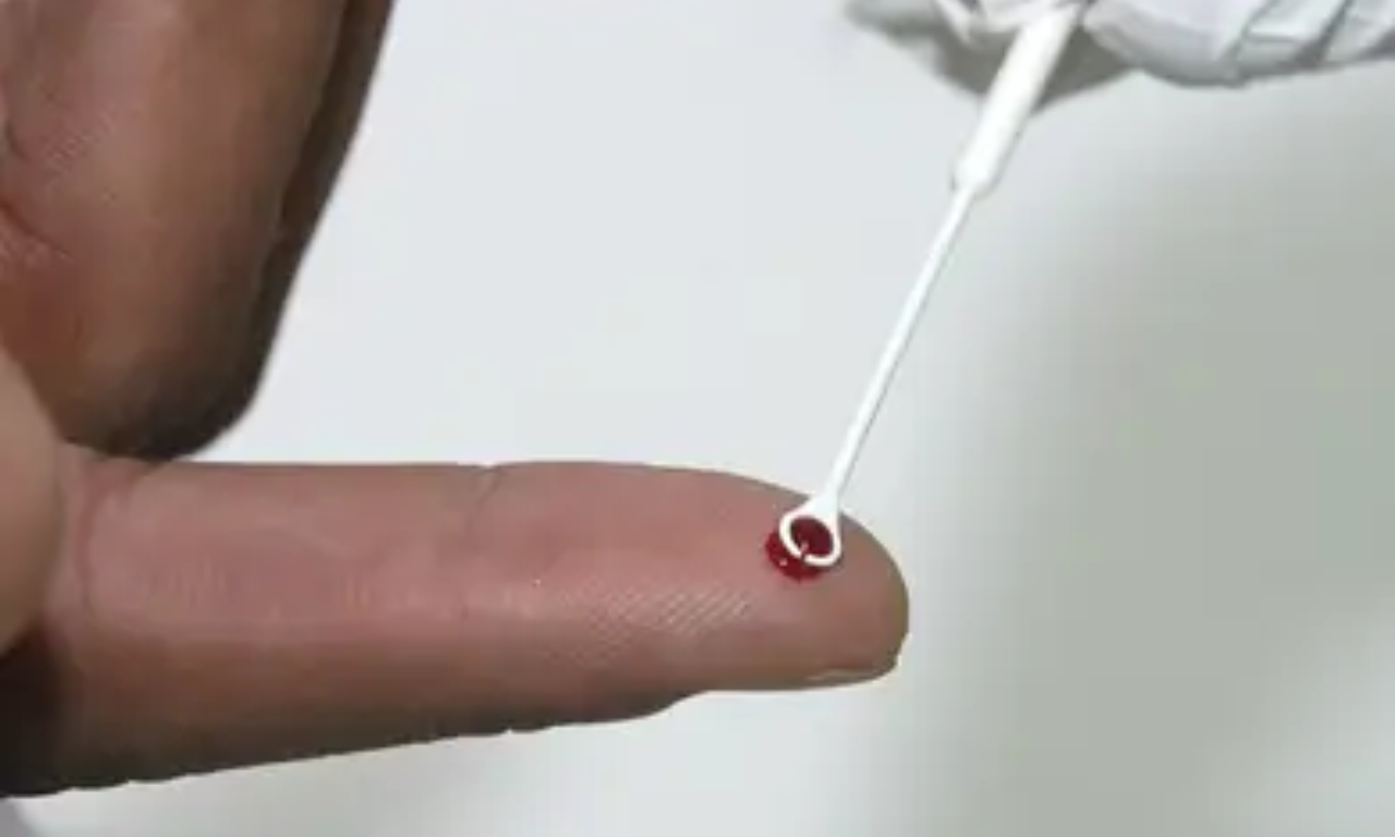 Sesba alerta para fake news sobre números de HIV.Foto: Reprodução
