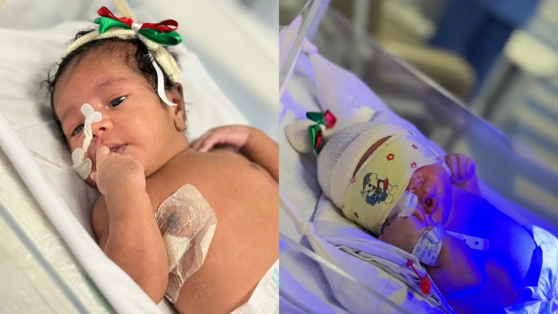 Levar decorações natalinas para a maternidade é importante porque cria um ambiente mais acolhedor e festivo, ajudando a reduzir o estresse e marcar o nascimento do bebê como um momento especial/Foto: Ascom/FESF-SUS