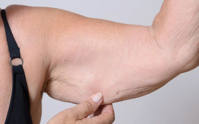 Caneta para m&uacute;sculos surge como aposta da ci&ecirc;ncia contra a perda de massa muscular, problema que pode afetar for&ccedil;a, mobilidade e autonomia com o passar dos anos/Foto: Reprodu&ccedil;&atilde;o&nbsp;