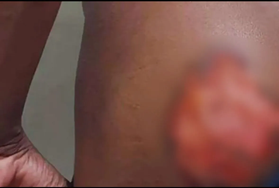 Polícia prende irmãos por tortura de jovem com deficiência na Bahia