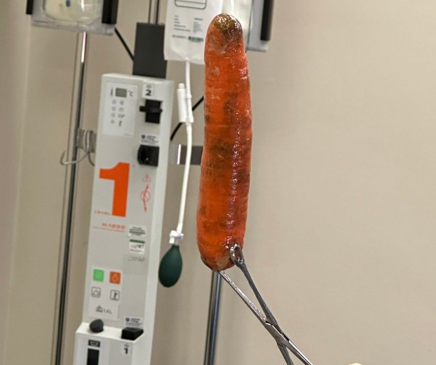 Médico retirou a cenoura do ânus. Foto: Rede social / 