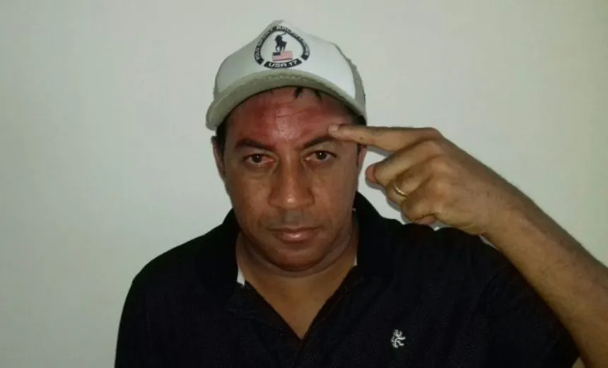 Ex-jogador é agredido após discussão com irmão do prefeito de Santo Antônio de Jesus