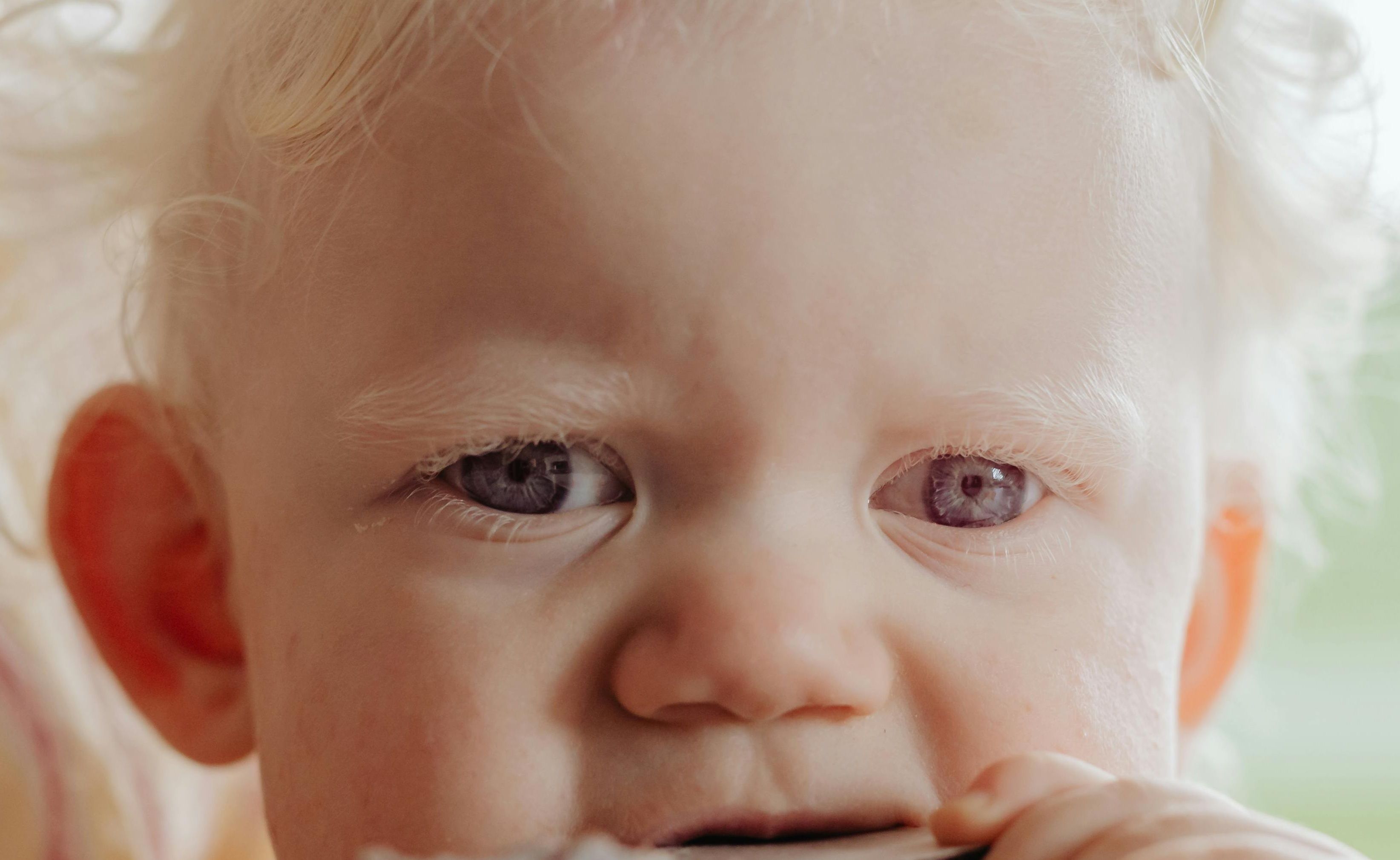 Olhos violetas ocorrem em casos extremos de albinismo. | Foto: Ilustrativa/Pexels