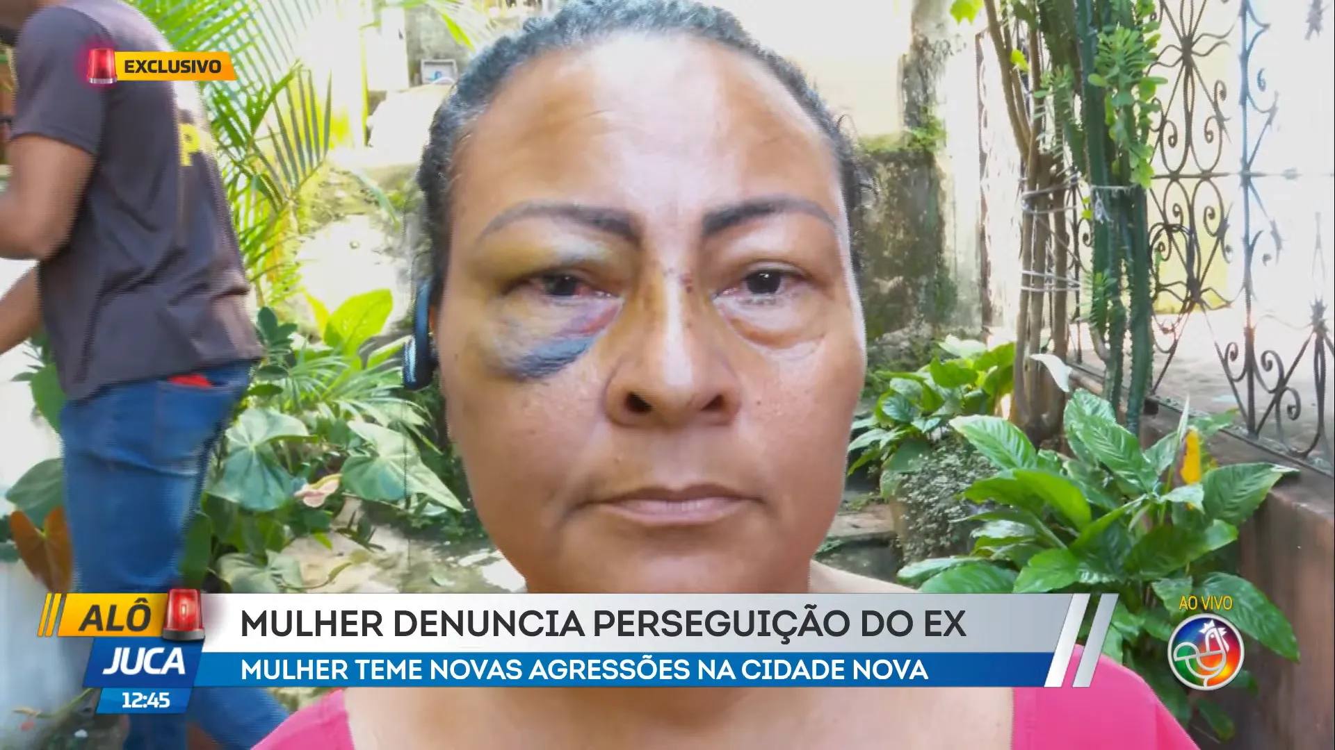 Mulher é espancada por ex-marido e companheira em Salvador: 'Vou passar por cirurgia'