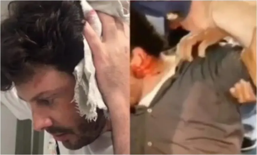 Apresentador Danilo Gentili leva garrafada na cabeça durante gravação e deixa estúdio sangrando