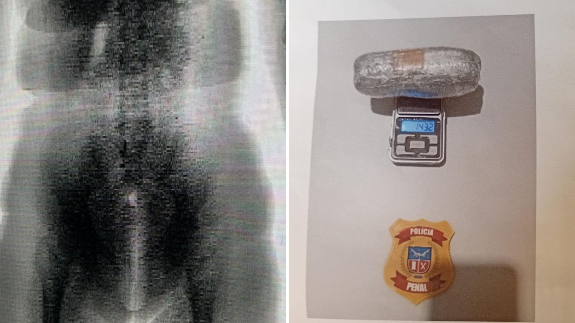 Drogas escondidas nas partes íntimas em presídio. Foto: Seap