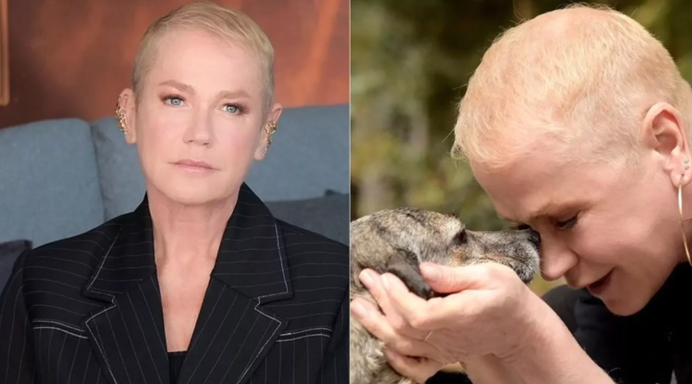 Xuxa Meneghel faz implante capilar e espera inspirar mulheres com alopécia androgenética.  /  Reprodução/ Instagram @bladmeneghel