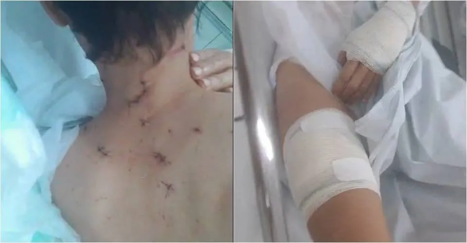 Motorista de app leva mais de 20 facadas e escapa após se fingir de morta: 'Deus salvou'