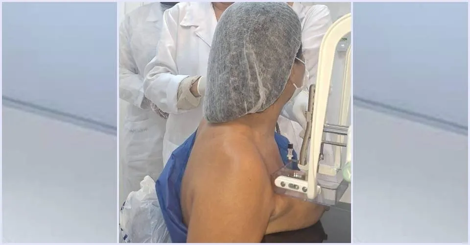 Hospital Aristides Maltez moderniza tecnologia no combate ao câncer de mama