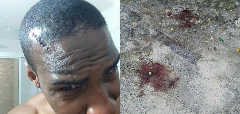 Governador Rui Costa pede apuração rigorosa da denúncia de agressão de PMs contra jornalista