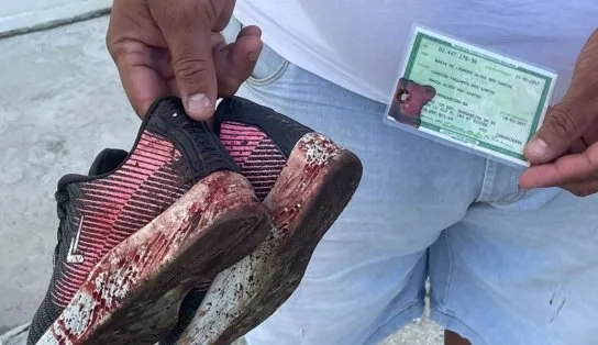 Idosa que foi baleada durante caminhada precisará passar por nova cirurgia para reconstruir orgãos; vídeo