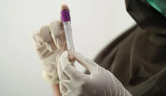 Gana confirma duas mortes por doença de Marbug, causada por vírus da mesma família do Ebola