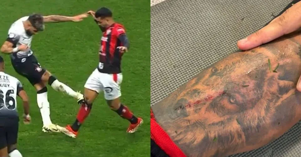 Vitória encaminha representação à CBF contra árbitro de partida diante do Corinthians