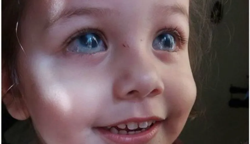 Após cirurgia nos EUA, criança brasileira enxerga e ouve a mãe pela primeira vez; Veja vídeo