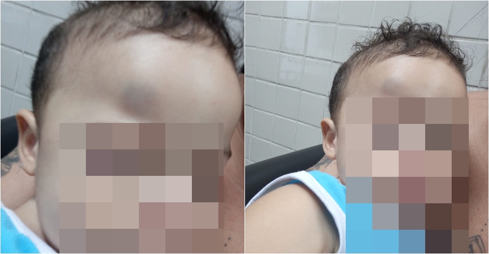 Bebê de 11 meses cai da maca e bate a cabeça após cirurgia no Hospital ...