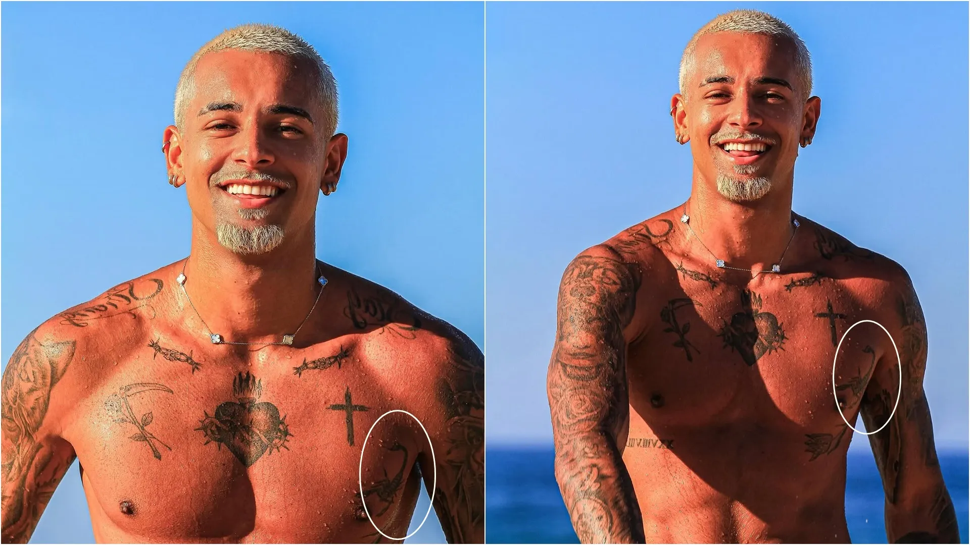 Tatuagem vai ser removida. | Foto: @wlguimaraess