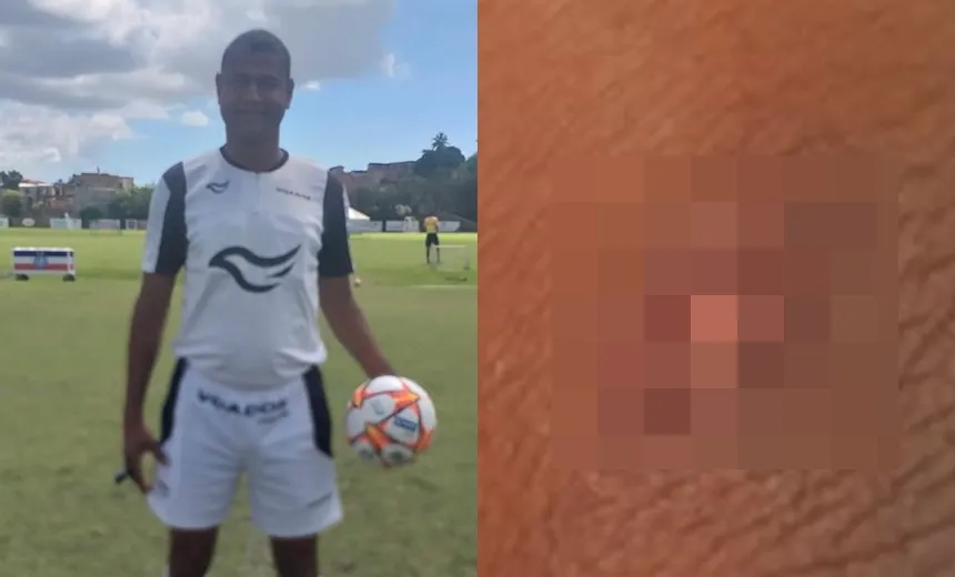 Campeonato da Guarda de Salvador acaba em confusão e árbitro agredido; "revolta depois de expulsão"