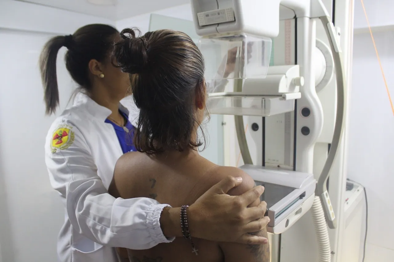Ferreira Costa Barris oferece exames gratuitos de mamografia