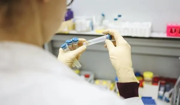 Brasil tem mais de 20 mil casos de Covid-19 registrados nesta segunda-feira; quase 44 mil morreram