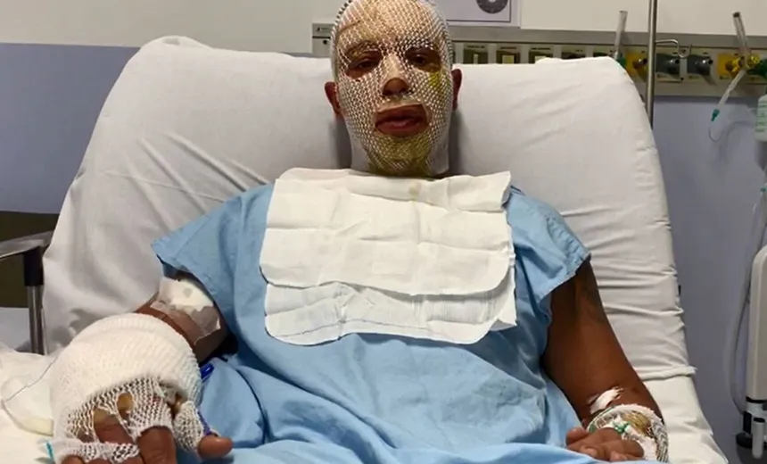 Em vídeo, prefeito de Osasco lembra acidente com fogueira de São João e exige investigação