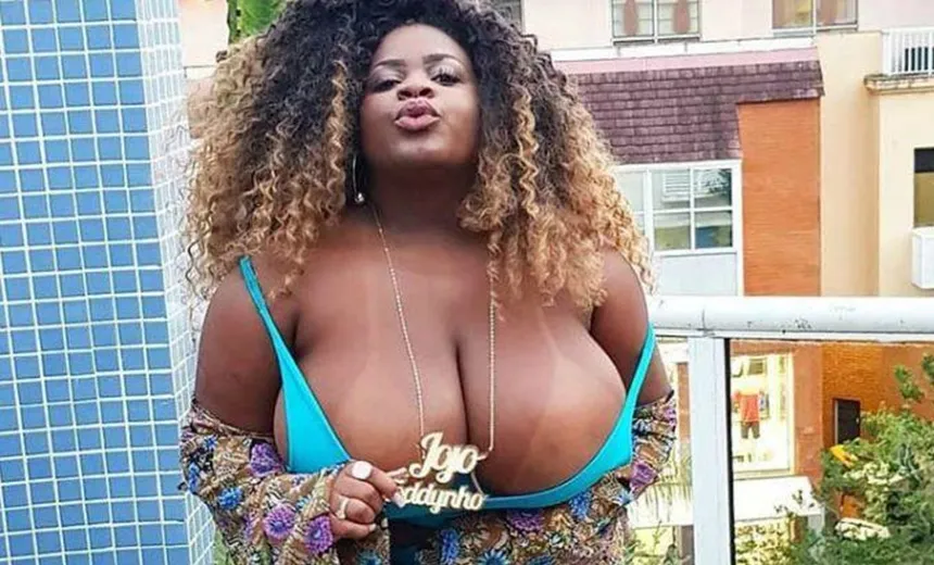 VEJA ANTES E DEPOIS: Jojo Todynho faz procedimento estético no rosto