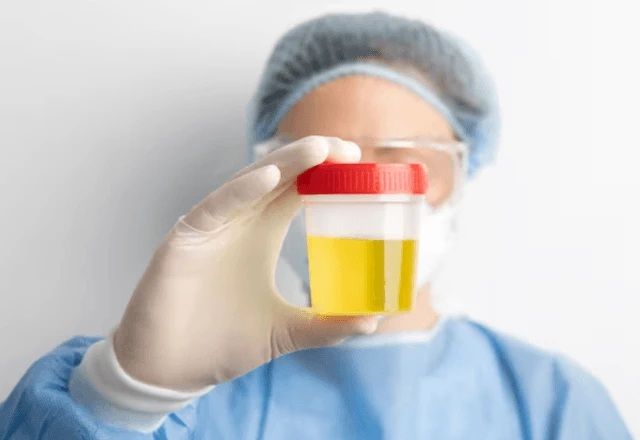 Xixi Escuro Ou Com Espuma Veja Quando Ficar Atento  Freepik