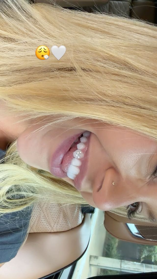 Virginia Fonseca Coloca Diamantes Cravejados No Dente Em Formato De Letra V Reprodu&ccedil;&atilde;o Instagram