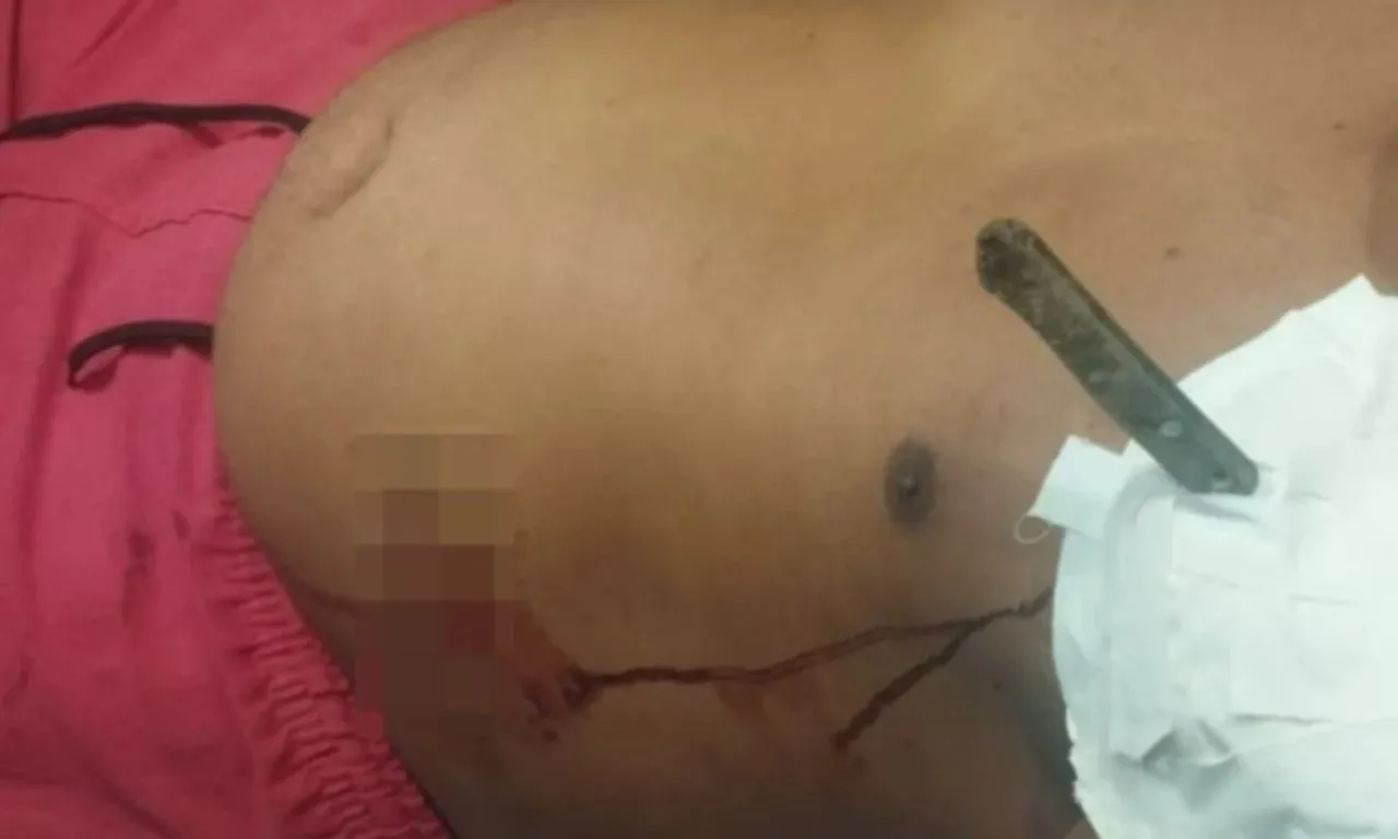 Homem é atacado e fica com faca cravada no corpo na Bahia