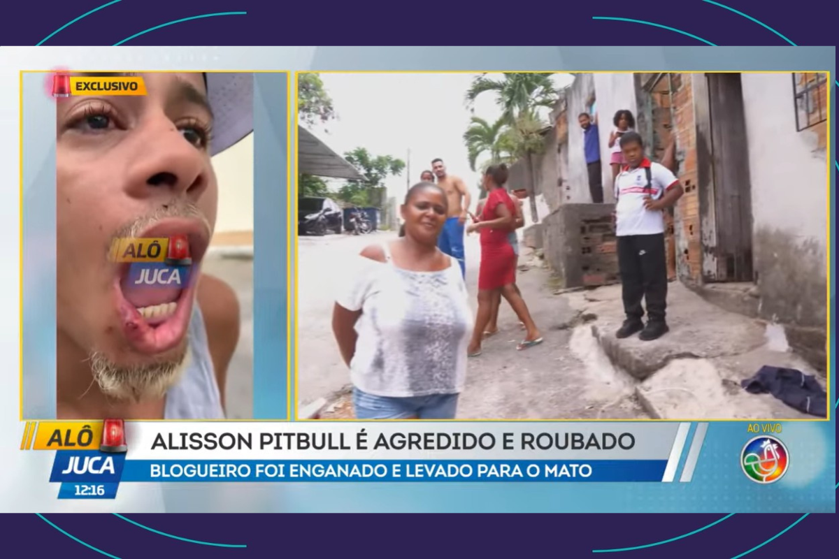 Blogueiro &Eacute; Agredido E Tem Dente Quebrado Durante Assalto Na Porta De Casa (2)