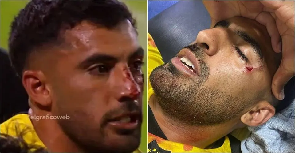 Lateral do Peñarol recebe pedrada no rosto atirada por torcida adversária em jogo da Libertadores