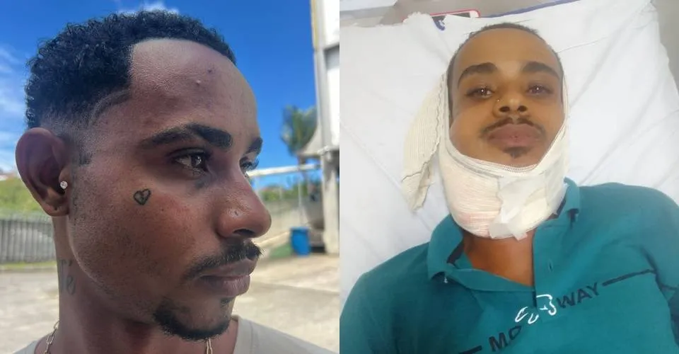 Homem denuncia ter sido agredido pela Guarda Civil Municipal no Comércio