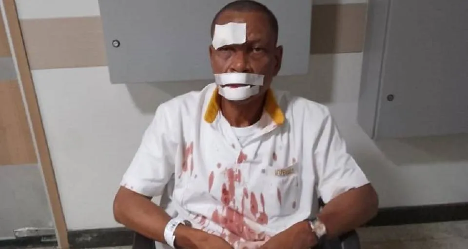 Sindicato dos Rodoviários descarta paralisação após agressão a motorista