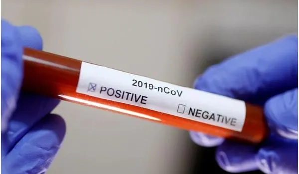 Secretaria de Saúde confirma vigésimo primeiro óbito por Covid-19; caso foi notificado em Lauro de Freitas