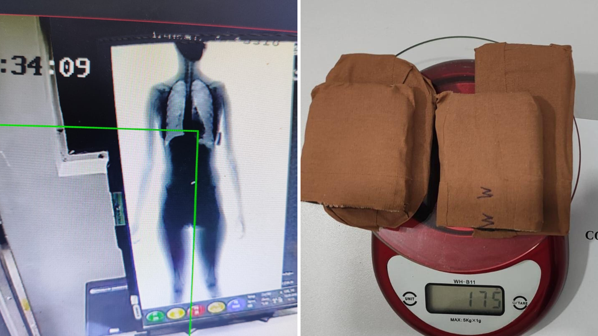 Equipamento de bodyscan identificou drogas em mulher de detento. Foto: divulgação