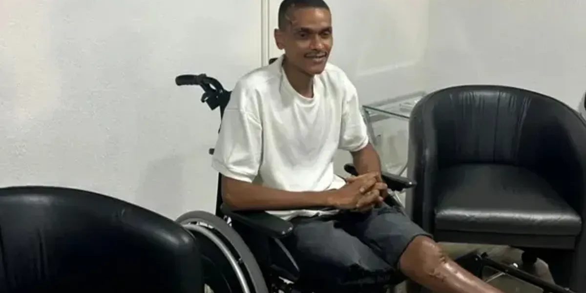 Atleta &Eacute;merson Pinheiro, que teve a perna amputada ap&oacute;s atropelamento em Salvador