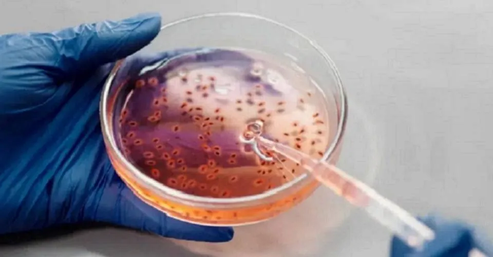 Casos de mpox no Brasil este ano já superam 2023; Salvador está entre as 4 cidades com mais afetadas