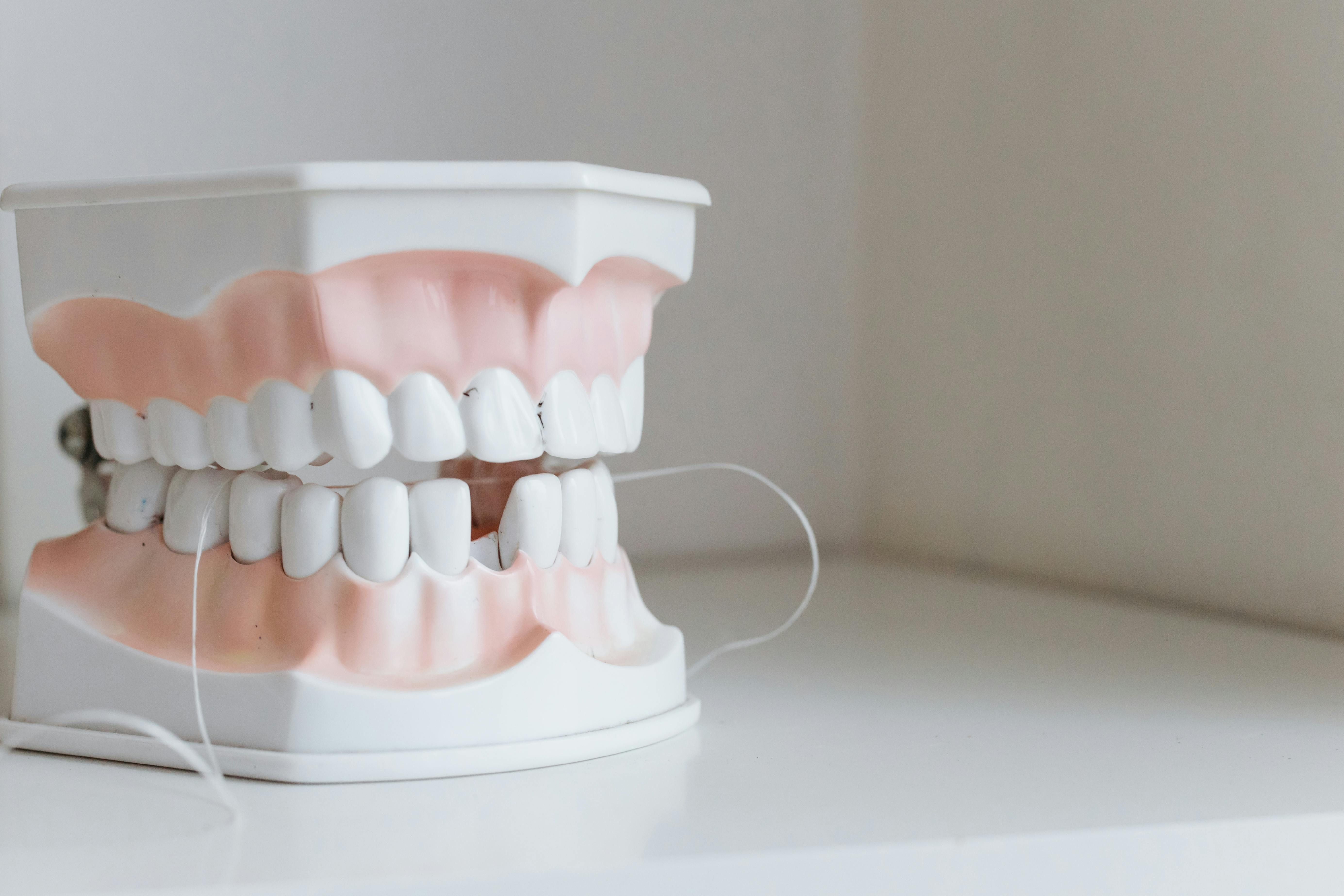 Os resultados apontaram uma redução significativa no risco de AVC entre os participantes que usaram fio dental regularmente. | Foto: Ilustrativa/Pexels