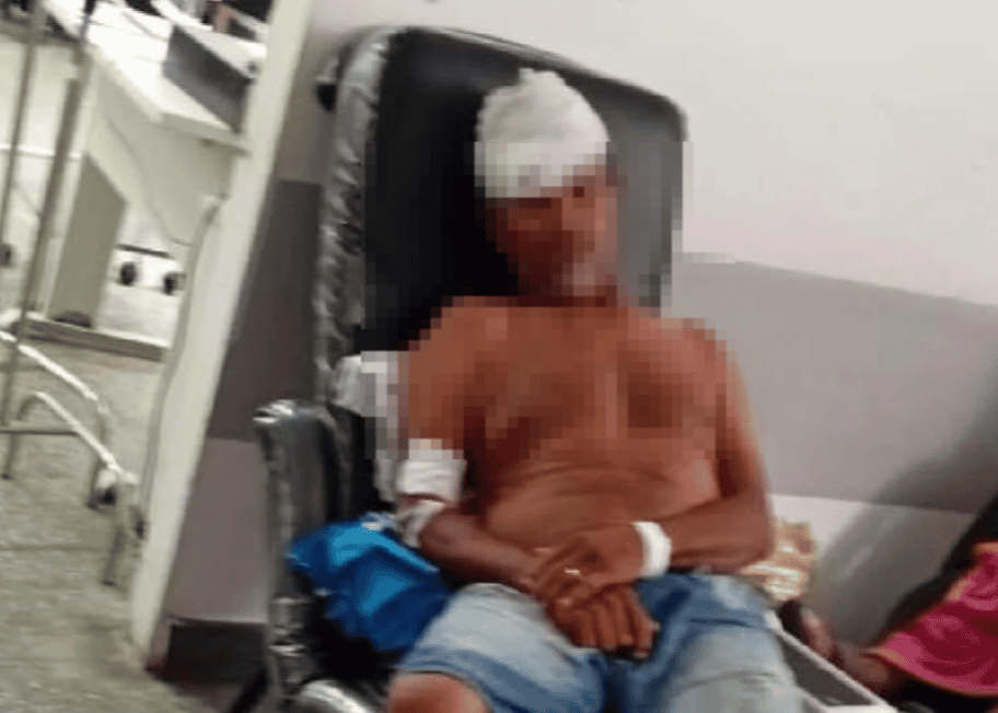 Eleitor morre ap&oacute;s tr&ecirc;s dias internado depois de ser espancado no dia das elei&ccedil;&otilde;es em Ilh&eacute;us. Foto: Reprodu&ccedil;&atilde;o Redes Sociais 