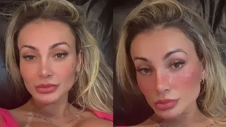 Andressa Urach conta que fez tatuagem de sardas no rosto: 'Cara de ninfetinha'