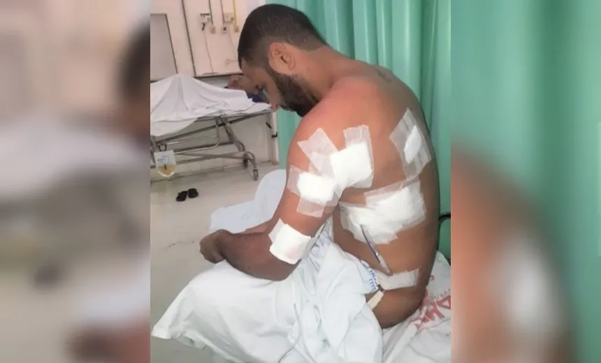 "Vivi um filme de terror", diz vítima de tentativa de homicídio por homofobia em Camaçari